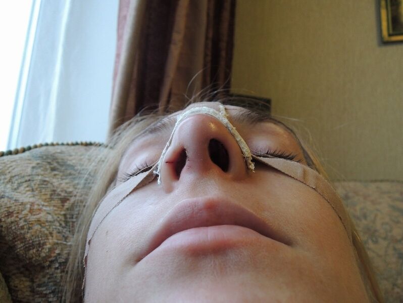 рехабилитация