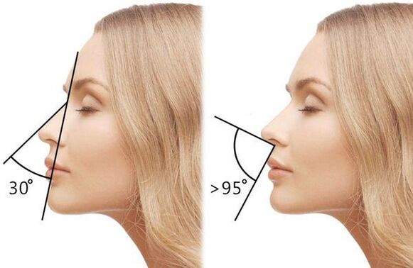 измерване на ъгъла на носа